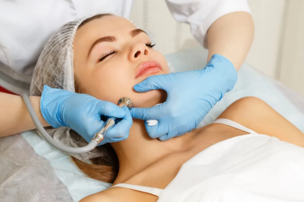 Diamond Dermabrasion