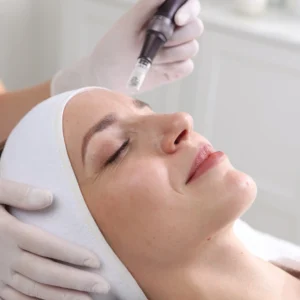 Microneedling E-pan